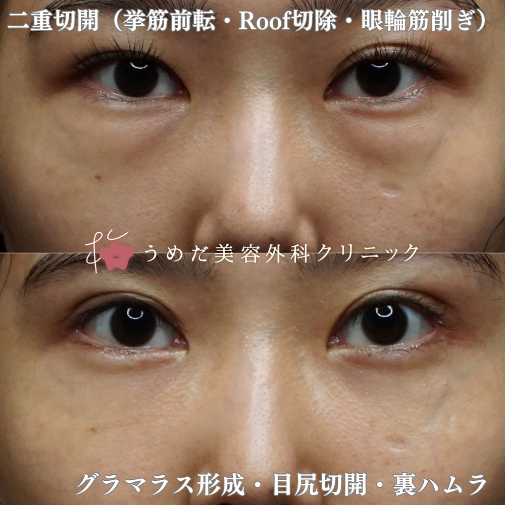 裏ハムラ1