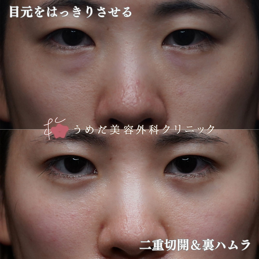 裏ハムラ2